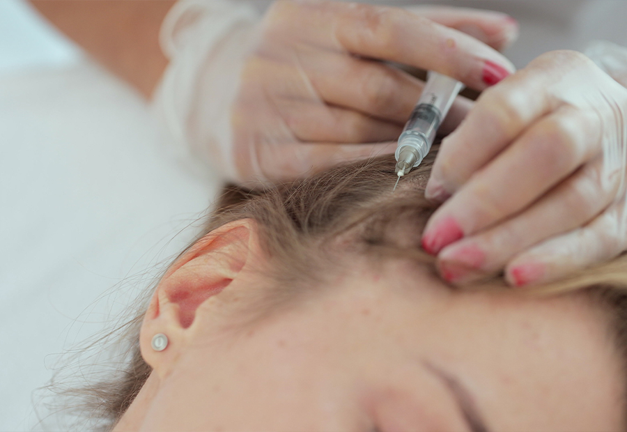 PRP Tunisie : injection plasma riche en plaquettes pour le visage et les cheveux